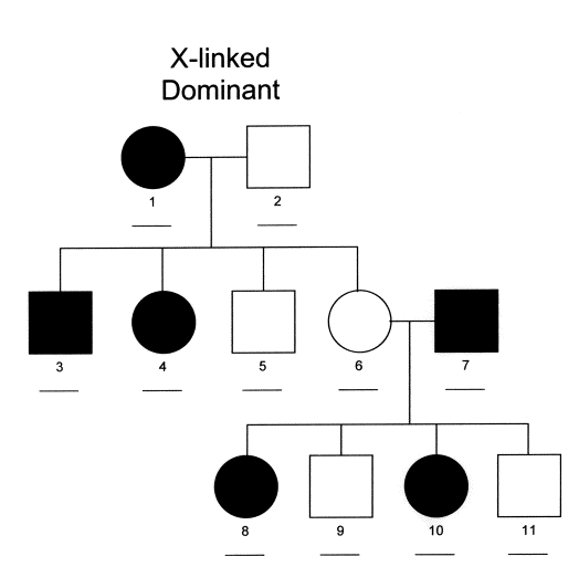 Sex-linked Dominant Inheritance Pedigree Chart